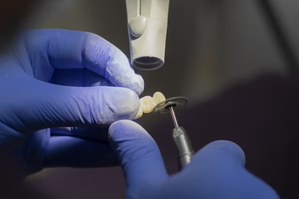 5 Habits That Secretly Damage Your Teeth Every Day