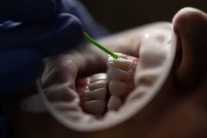 The Unexpected Link Between Oral Health and Longevity